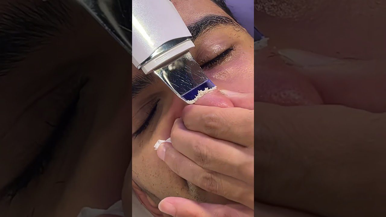 Laiminga odos priežiūros rutina diena #juodosios dėmės #odos priežiūra #odos priežiūros rutina