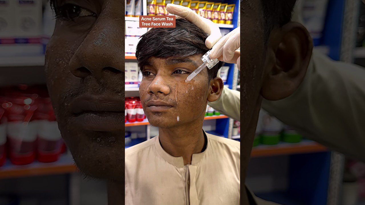 Švytintis ir valantis spuogų serumas ir arbatmedžio veido prausiklis Nuostabūs #ameenbeautytips