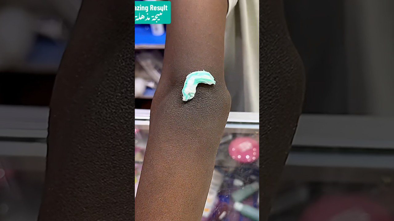 Gilus valymas, pašalinantis dulkes ir negyvas odos ląsteles #ameenbeautytips