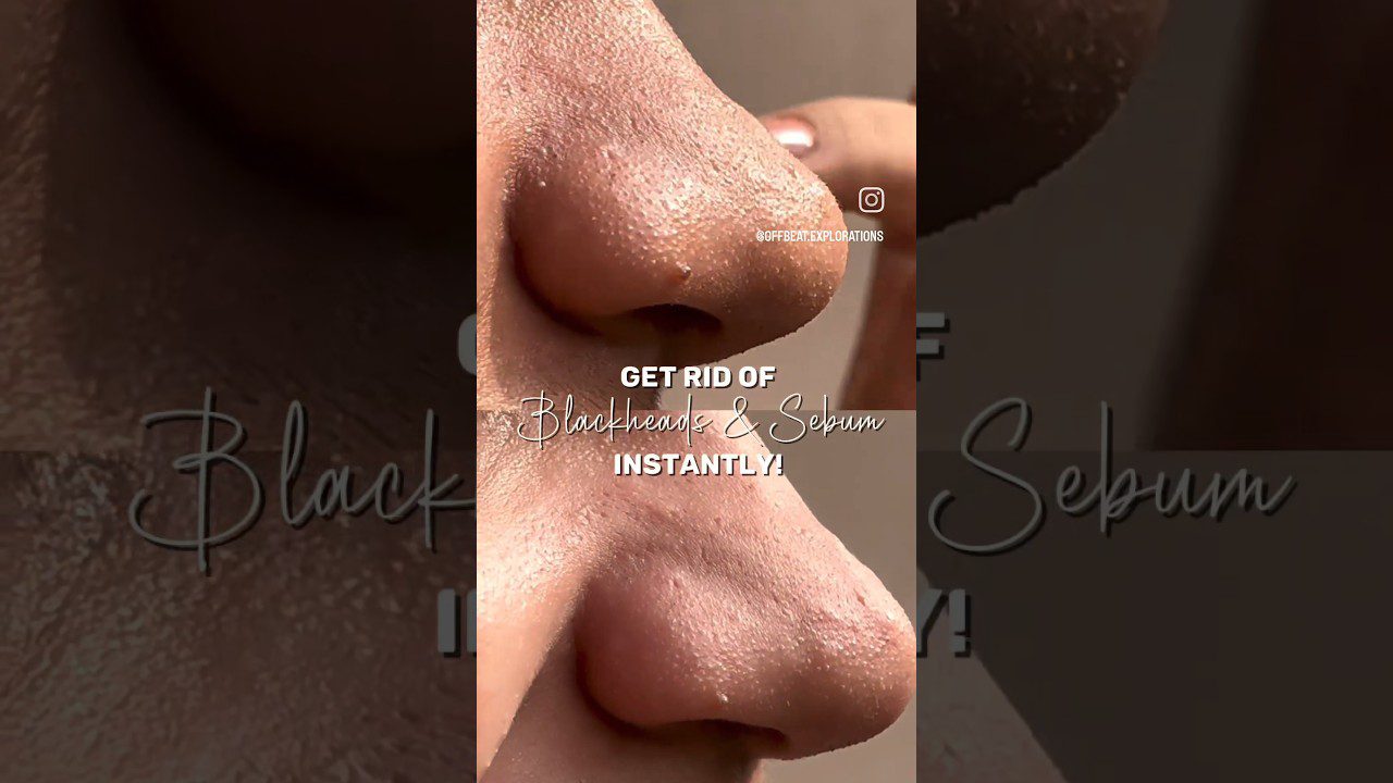 Artimos nosies nuotraukos su matomomis poromis ir juodaisiais taškeliais, tekstas: "Pašalinkite komedonus".