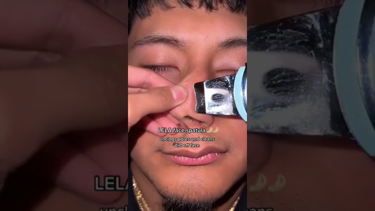 jaunas vyras su užmerktomis akimis, iš nosies pašalinami riebalų kamščiai ultragarso špachtle