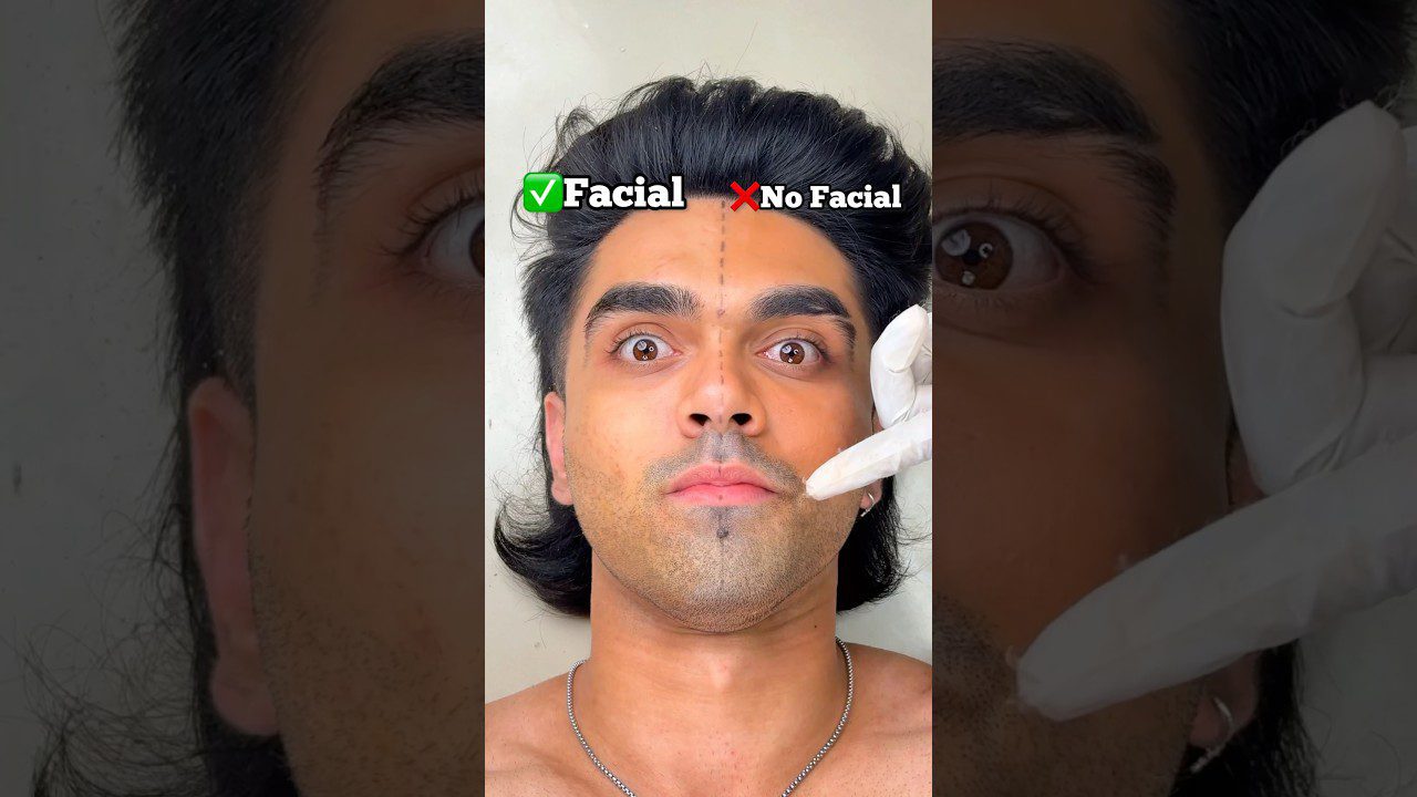 Vyras gulintis su pažymėta veido vidurio linija ir kosmetologės pirštu prie smakro