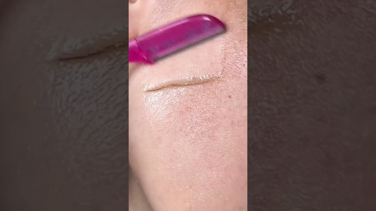 Rožinės skutimosi peiliuko briauna nuvalo ploną odos kaukės sluoksnį nuo skruosto