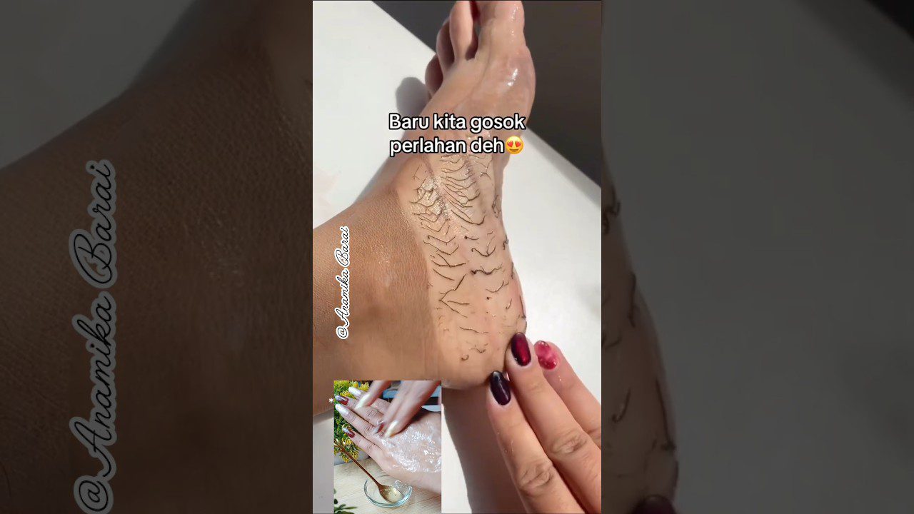 Pėdos padažas su ištrinamu geliu, ranka trinanti susikaupusią negyvą odą