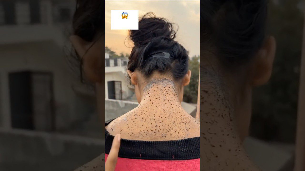 moteris nugara ir kaklas su didele žvynelių ar šveitimo dalelių apnaša, surišti plaukai