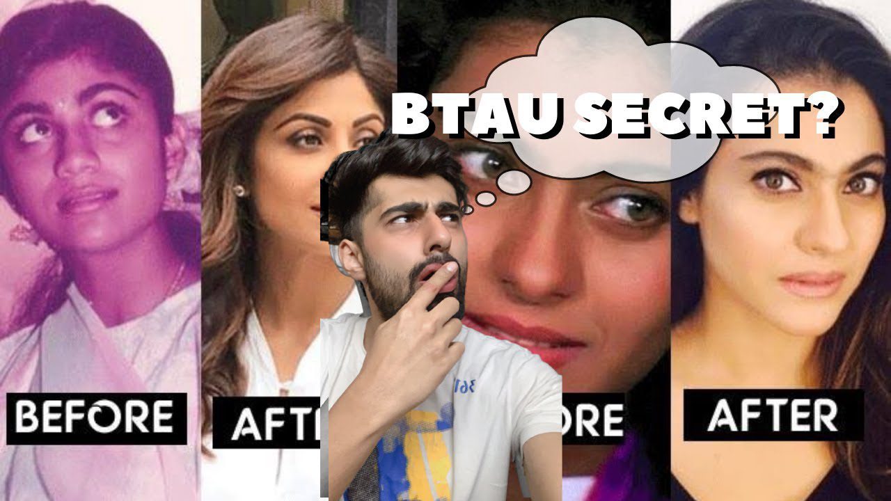 Vyras galvoja prieš ir po grožio transformacijų nuotraukų koliaže su tekstu „BTAU SECRET?“