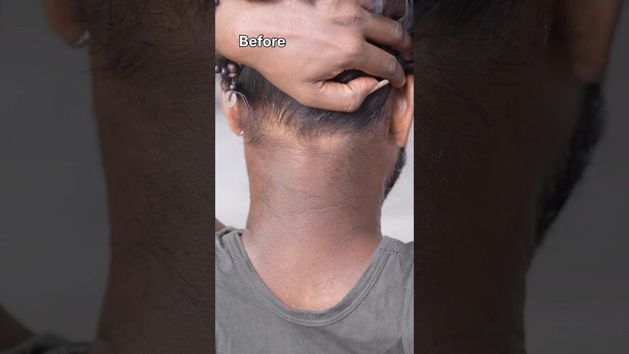 Pašalink kaklo tamsumą namuose per 5 minutes | Kaklo valymo patarimai | Tamsaus kaklo šalinimo namų gynimo priemonės #trumpai