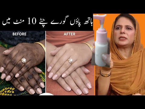 moters rankos prieš ir po išlygintos odos, dešinėje moteris rodanti odos balinimo putą ir užrašas urdu „10 minutėms“