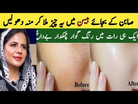 Moteris su šypsena kairėje; odos porų prieš ir po valymo nuotraukos dešinėje, užrašas vertimas į lietuvių: „Prieš“ ir „Po“.