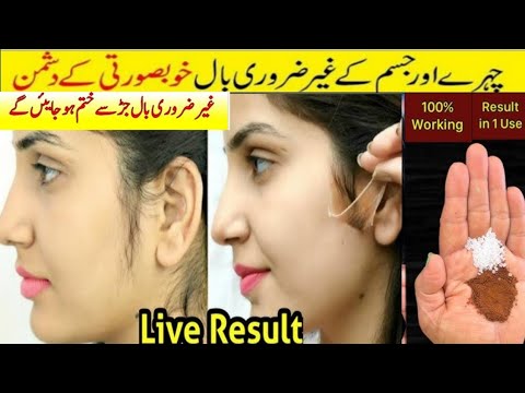 moteris iš šono rodoma prieš ir po plaukų šalinimo ant skruosto, šalia ranka laiko druskos ir miltelių mišinį