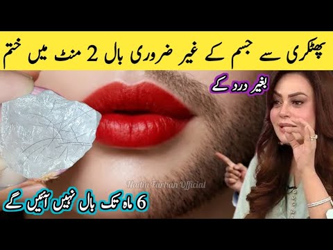 Vyrų veidas su raudonomis lūpomis, rankoje ledinis gabalėlis ir moteris aiškinanti receptą, užrašai apie plaukų slinkimą ir 2 minutes.