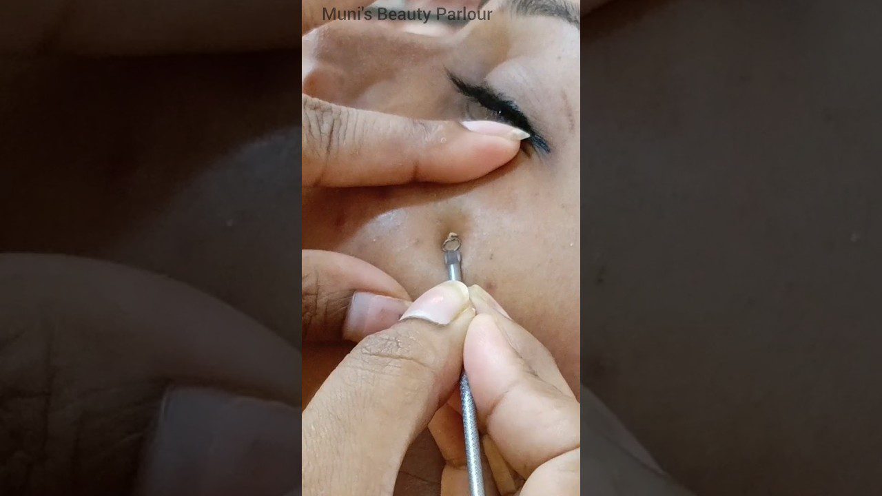 Rankos spaudžia veido odą ir išspauda inkštirą šalia užmerktos akies, matomas įrankis ir tekstas „Muni's Beauty Parlour“.