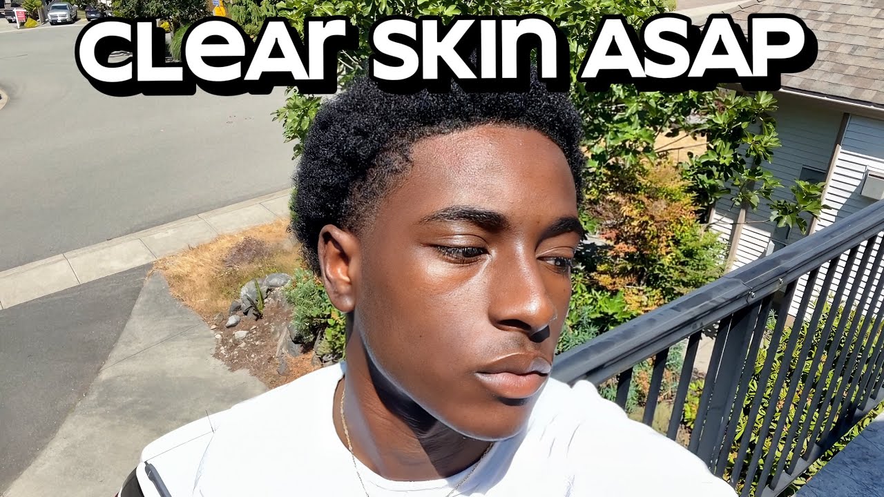 Jaunas vyras lauke saulėje rodo lygią veido odą, viršuje užrašas „Clear Skin ASAP“.