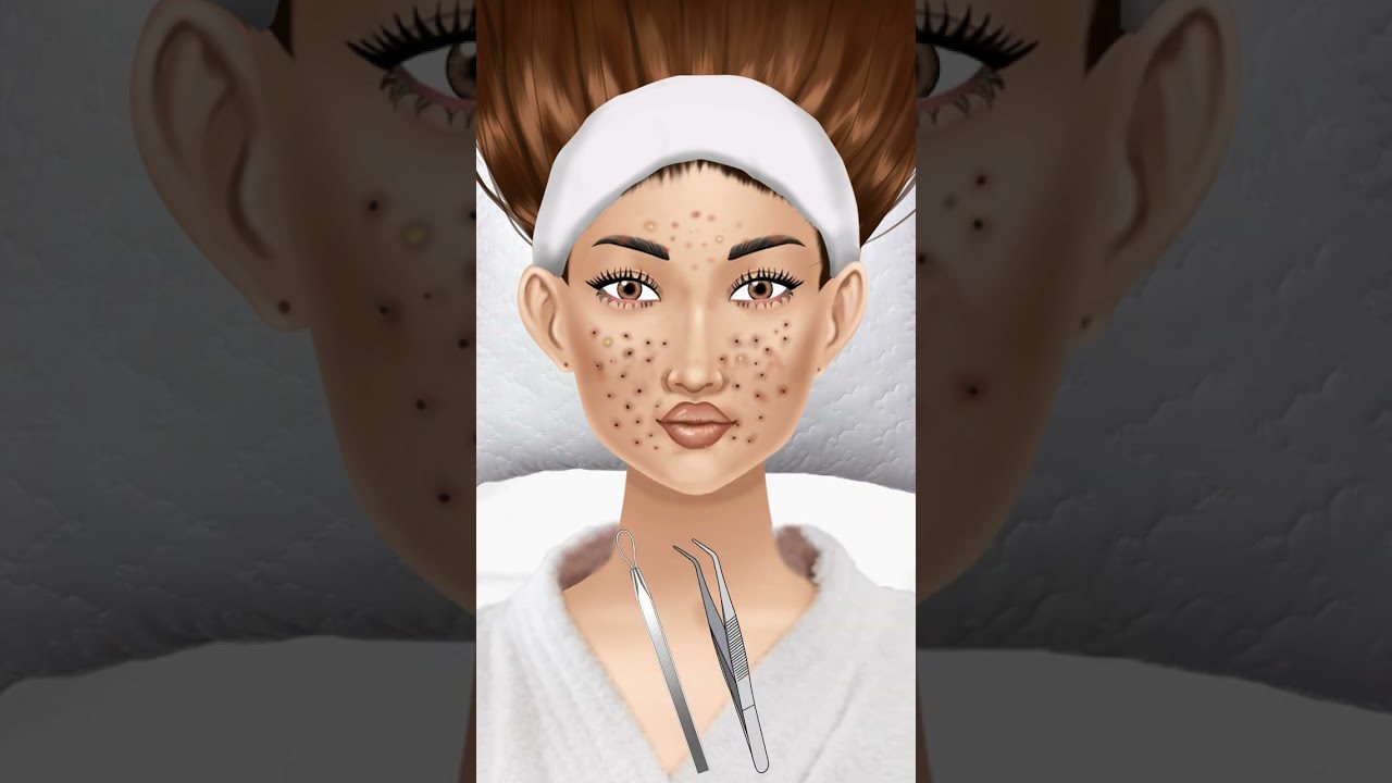 Moteris su galvos juosta ir daug spuogų ant veido, šalia komedonų spaustukų ir pinceto