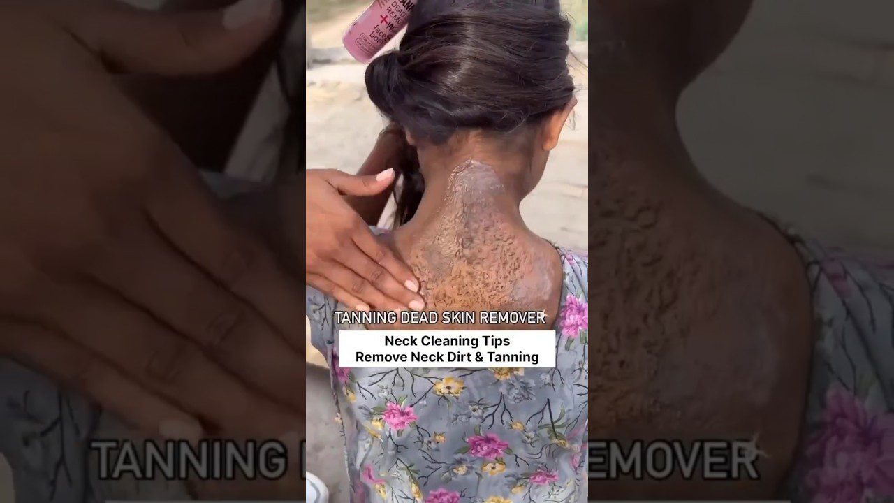 moteris tepasi nugaros kaklo odą šveitimo priemone, matomas lupimasis ir tirštas šveitimo gelis