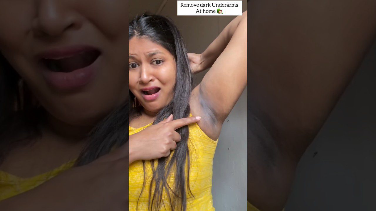 Moteris geltonais drabužiais rodantis tamsią pažasties odos dėmę ir nustebęs veidas