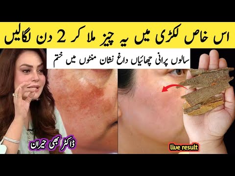 Moteris rodanti kremą ir odos paraudimo nuotrauką su užrašu apie dėmių šalinimą per 2 dienas