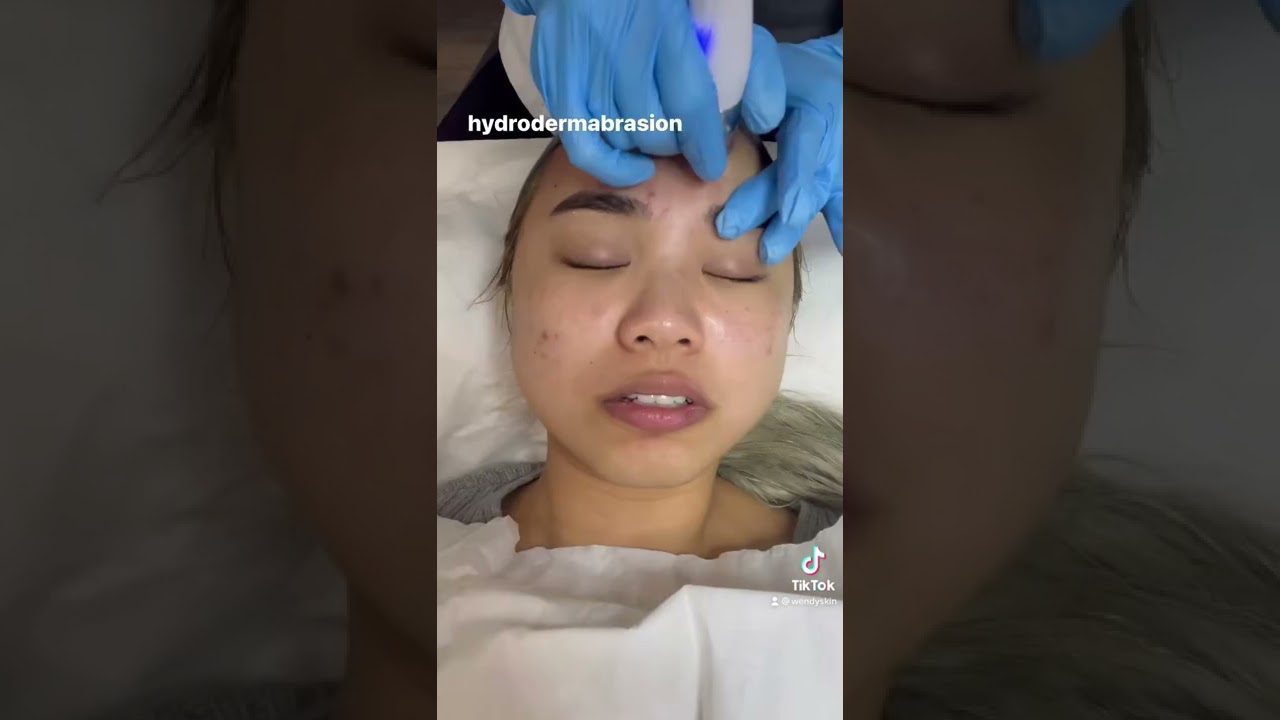 Mergina gulinti su užmerktomis akimis, jai ant kaktos atliekama hidrodermabrazija ir valomas veidas