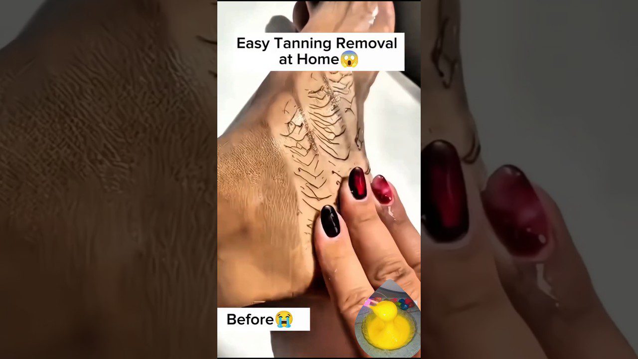 kojos kulnas su pašalintu įdegio sluoksniu ir ranka trina odą geliu