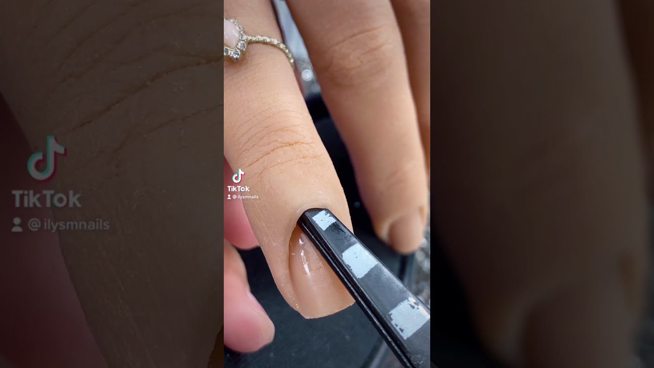 Rankos nykštis su natūraliu nagučiu, prie kutikulės klijuojama dirbtinė nagų formelė pincetu.