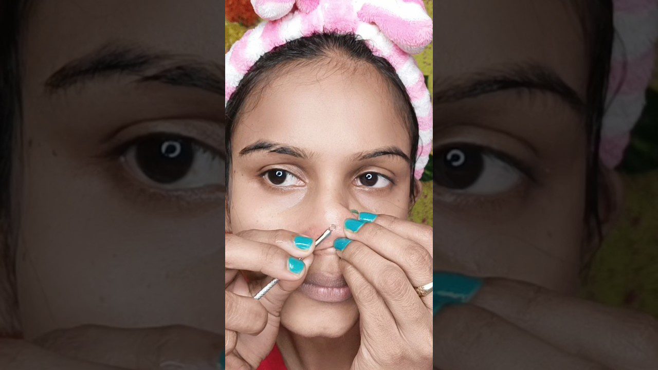 Moteris su rožine galvos juosta spaudžia nosį pincetu, šalina juostelės plaukelius ir spuogus