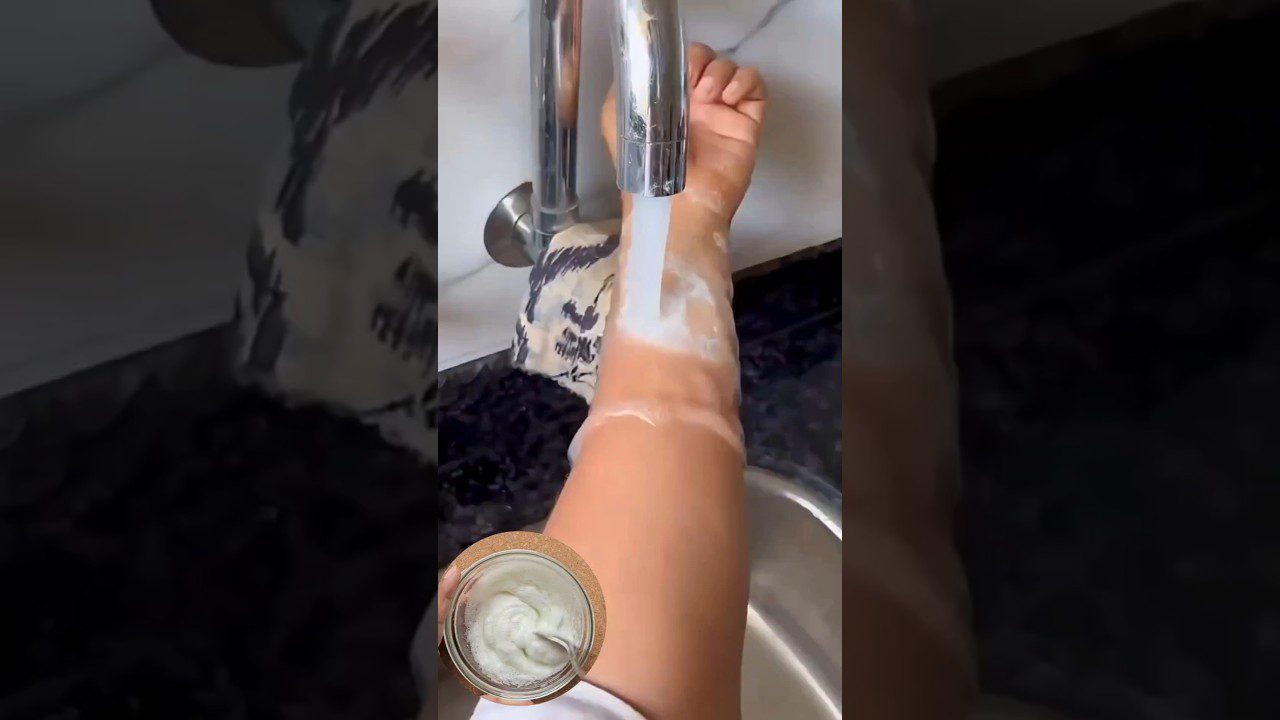 Rankos ir dilbio plovimas muilu po tekančiu čiaupo vandeniu, indą su putomis matyti apačioje.