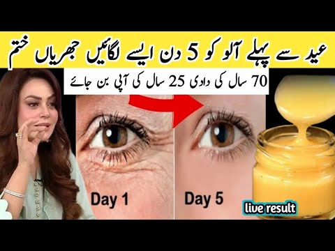 Moters akies raukšlės prieš ir po 5 dienų gydymo, kremas indelyje ir moters portretas