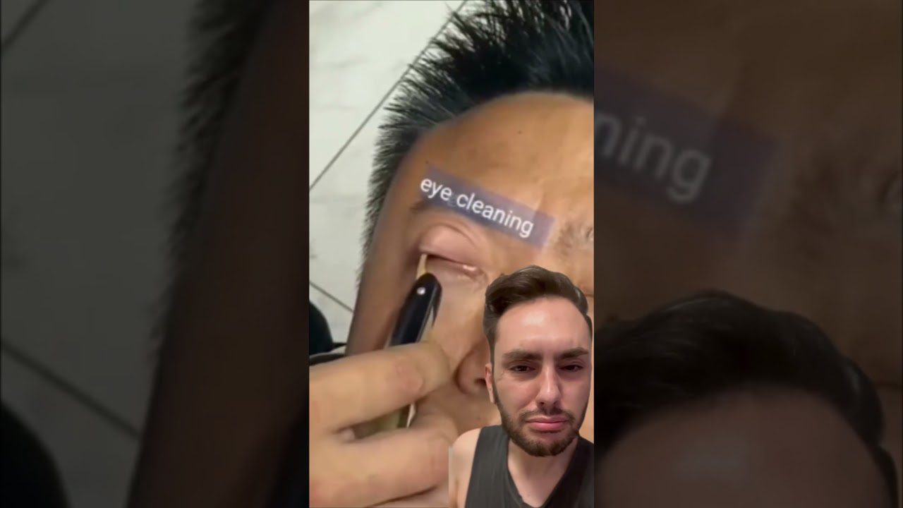 Vyrui atplėšiami vokai ir valomi akių vidiniai kampučiai, tekstas „eye cleaning“