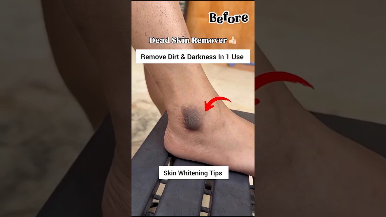 čiurna su tamsia dėme ant sąnario ir užrašu „Remove Dirt & Darkness In 1 Use“