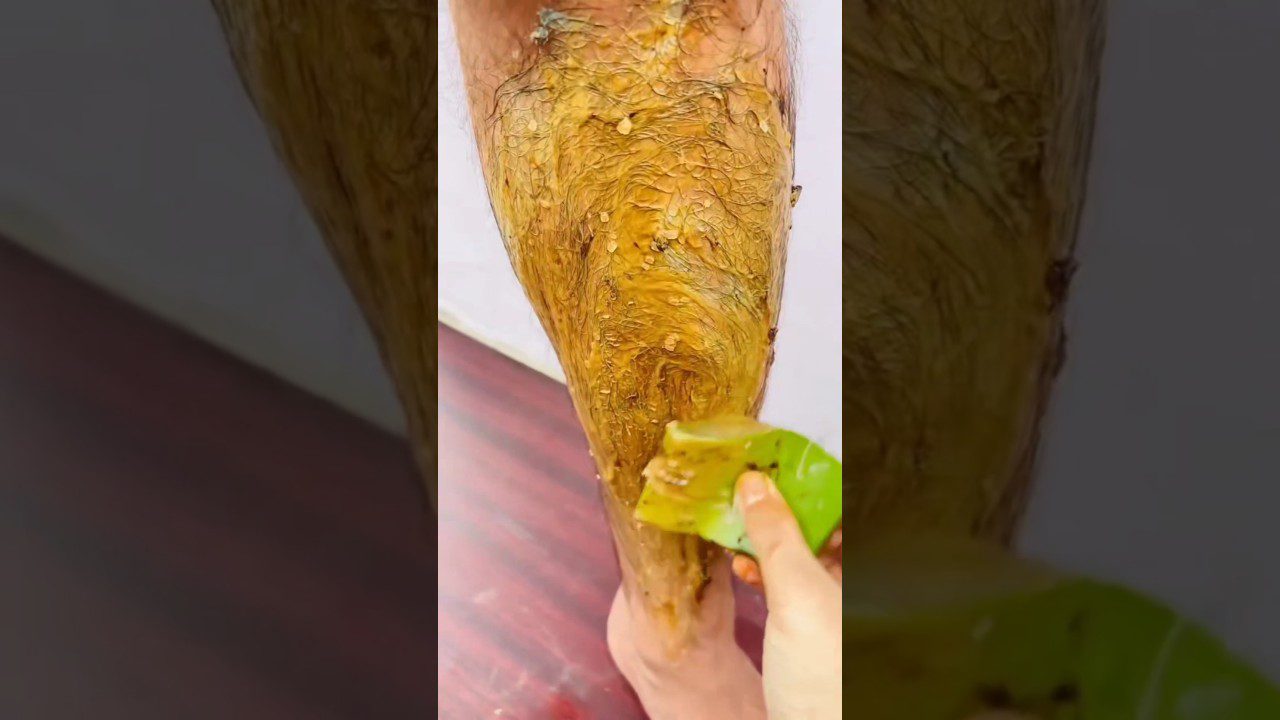 Viralinių kojų valymo lengvi patarimai/Pašalinkite nešvarumus, įdegį ir negyvą odą #negyvoda #įdegis #trumpi #viral