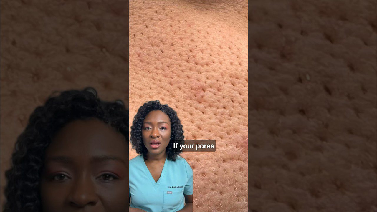 Dermatologė kalba prieš didintą veido porų makrovaizdą, ekrane užrašas „If your pores“