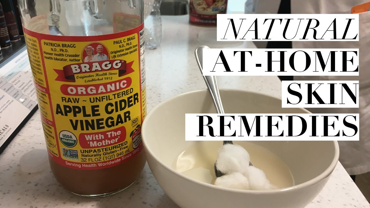 Bragg obuolių acto ąsotis šalia dubenėlio su vata ir šaukštu, tekstas „Natural at-home skin remedies“