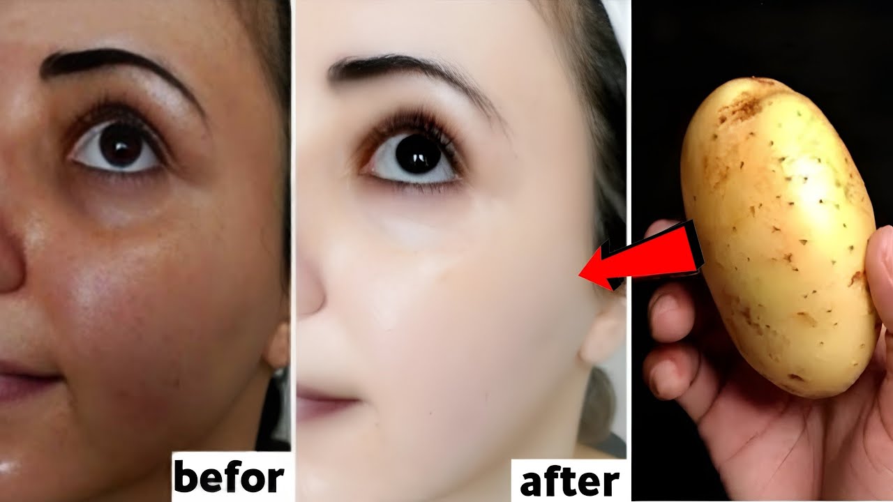 moterų veidų prieš ir po odos šviesinimo rezultatai šalia rankoje laikomos bulvės