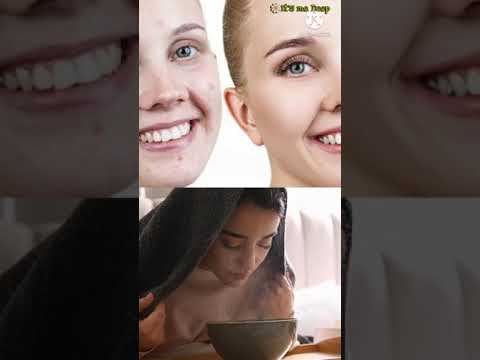 Kairėje nešvanki oda prieš valymą, dešinėje išlyginta oda; apačioje moteris kvėpuoja garais virš dubenėlio.